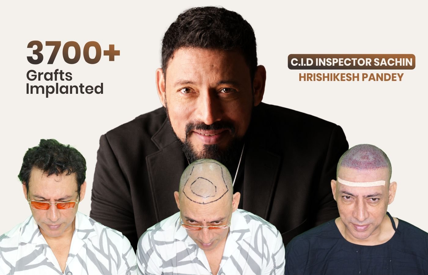 Hair restoration expert team